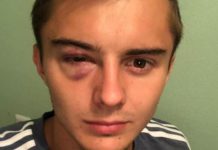 «Хватит валяться, не хочу много времени добавлять»: Александр Зуев о матче с «Уфой»